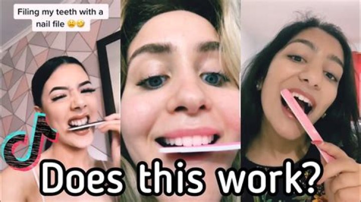 Alix Earle's 'insane' TikTok tooth hack leaves dentists' jaws on the floor