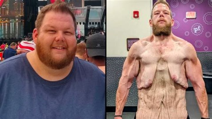 Jon Brower Minnoch's Historic Weight Loss: Before and After